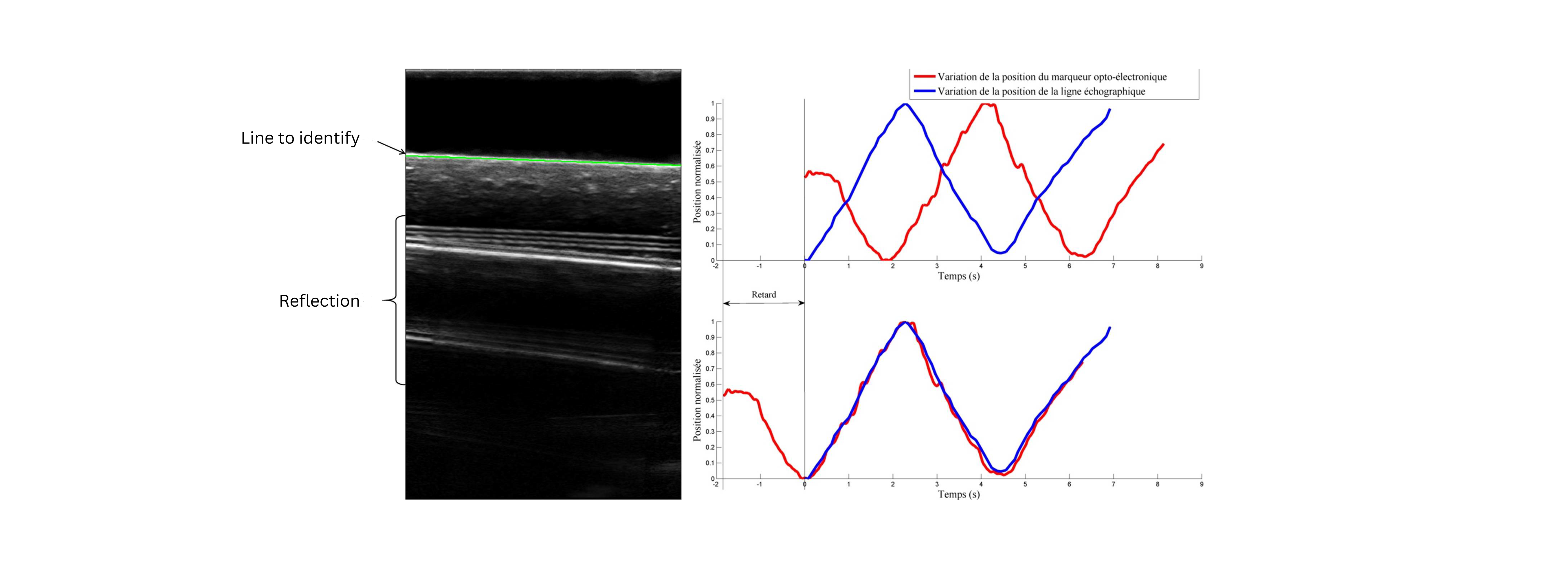 Figure 2. Measurement of the synchronization delay between opto-electronic and ultrasound systems