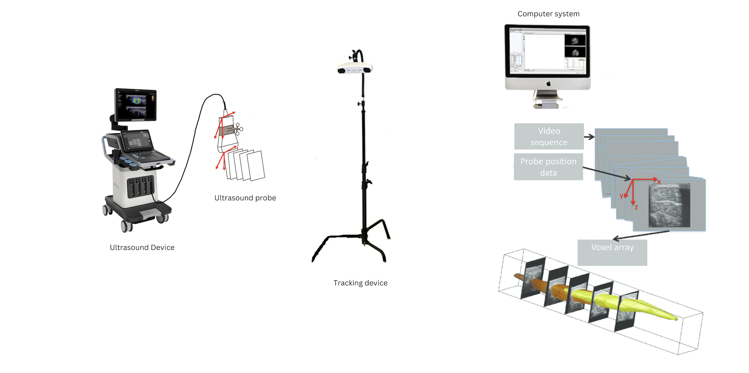 Figure 1. A freehand 3D ultrasound system. Made in Canva.com