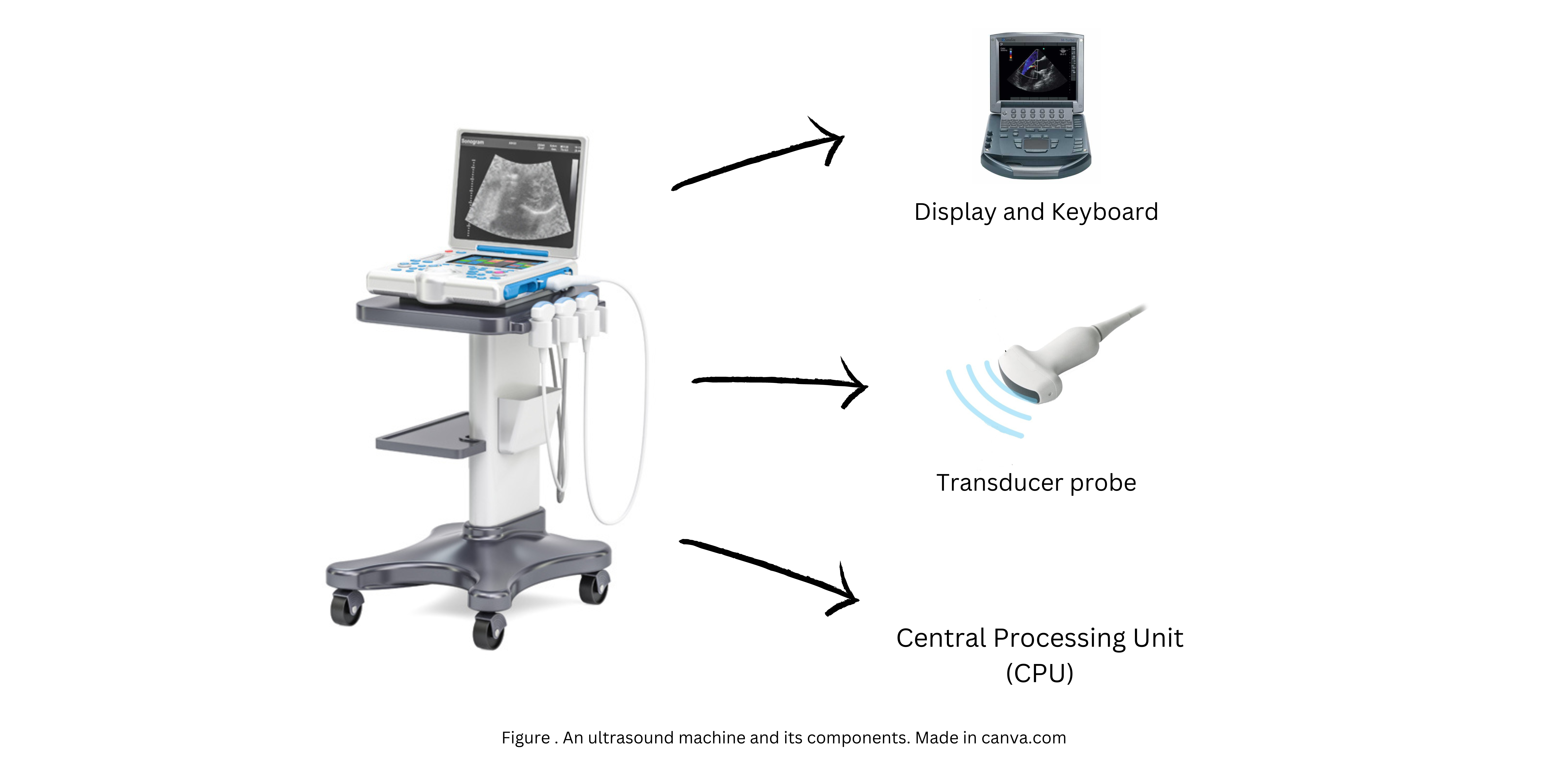 Trancducer Probe(1)